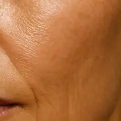 Primer plano de la piel con arrugas, mostrando la textura y las líneas de expresión, ideal para ilustrar cómo rejuvenecer el rostro.
