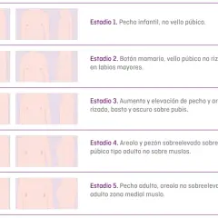 Gráfico de estadios de desarrollo puberal. Si mi hijo tiene 14 años y no se ha desarrollado, podría estar en el Estadio 1 o 2.