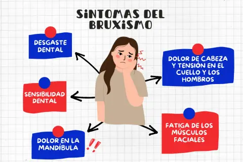 Ilustración de una niña con dolor de cabeza y mandíbula, mostrando síntomas del bruxismo como desgaste dental y tensión.