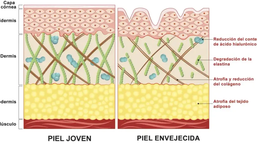 Comparación de piel joven y envejecida, mostrando la degradación de la elastina y la reducción de colágeno en la piel madura.