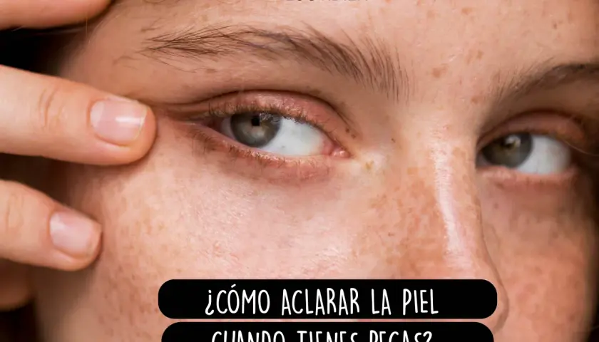 Primer plano de un ojo y mejilla con pecas. Un dedo tira suavemente de la piel del párpado inferior. Texto: "¿Cómo aclarar la piel cuando tienes pecas?".