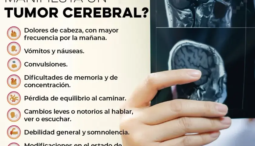 Síntomas de tumor cerebral que no debes ignorar para tu salud