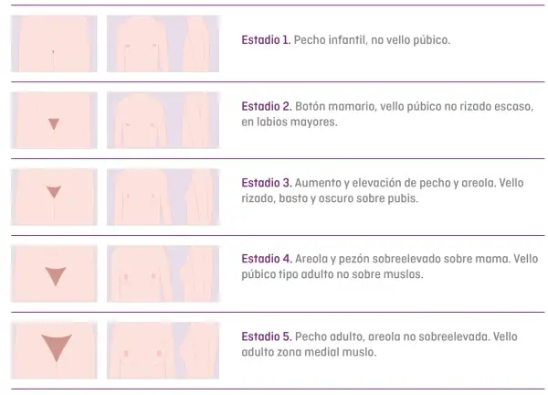 Gráfico de estadios de desarrollo puberal. Si mi hijo tiene 14 años y no se ha desarrollado, podría estar en el Estadio 1 o 2.